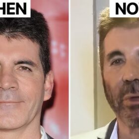 Top 3 Non-Surgical Aesthetic Treatments for Men - ZEN HEALTHCARE DUBAI